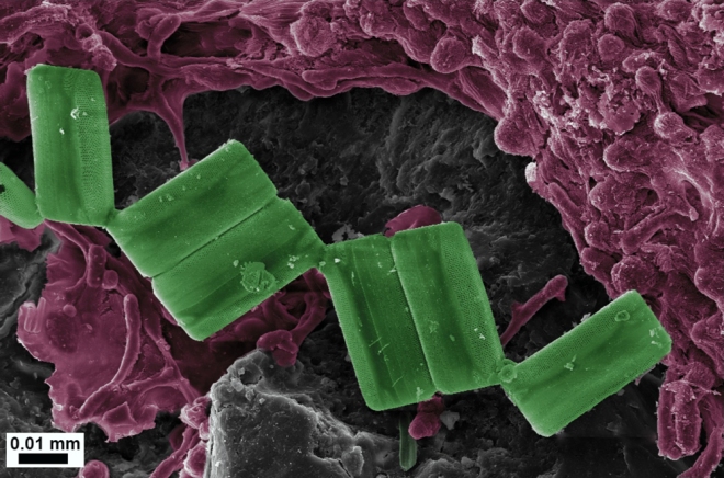 Diatomee (verde) e batteri (lilla) su un pezzo di plastica. Credito Julia Reisser e Jeremy Shaw.
